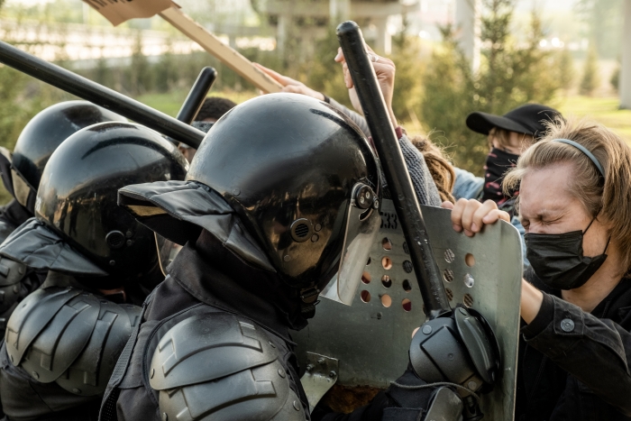 Taser and Baton Injuries: Documenting Neuromuscular and Orthopedic Harm for Damages Image